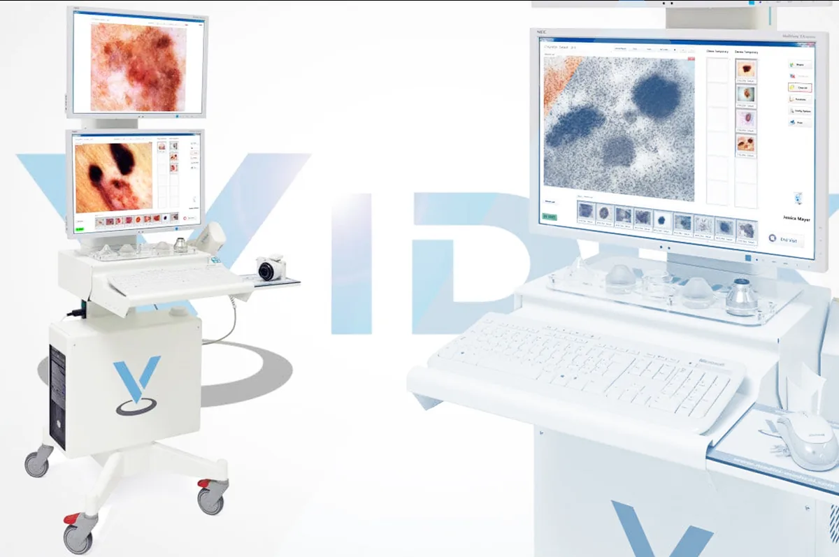 Setup VIDIX al Centro Eudermia di Cagliari — videodermatoscopio digitale ad alta risoluzione
